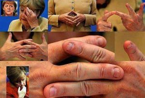 fingernaegelmerkel